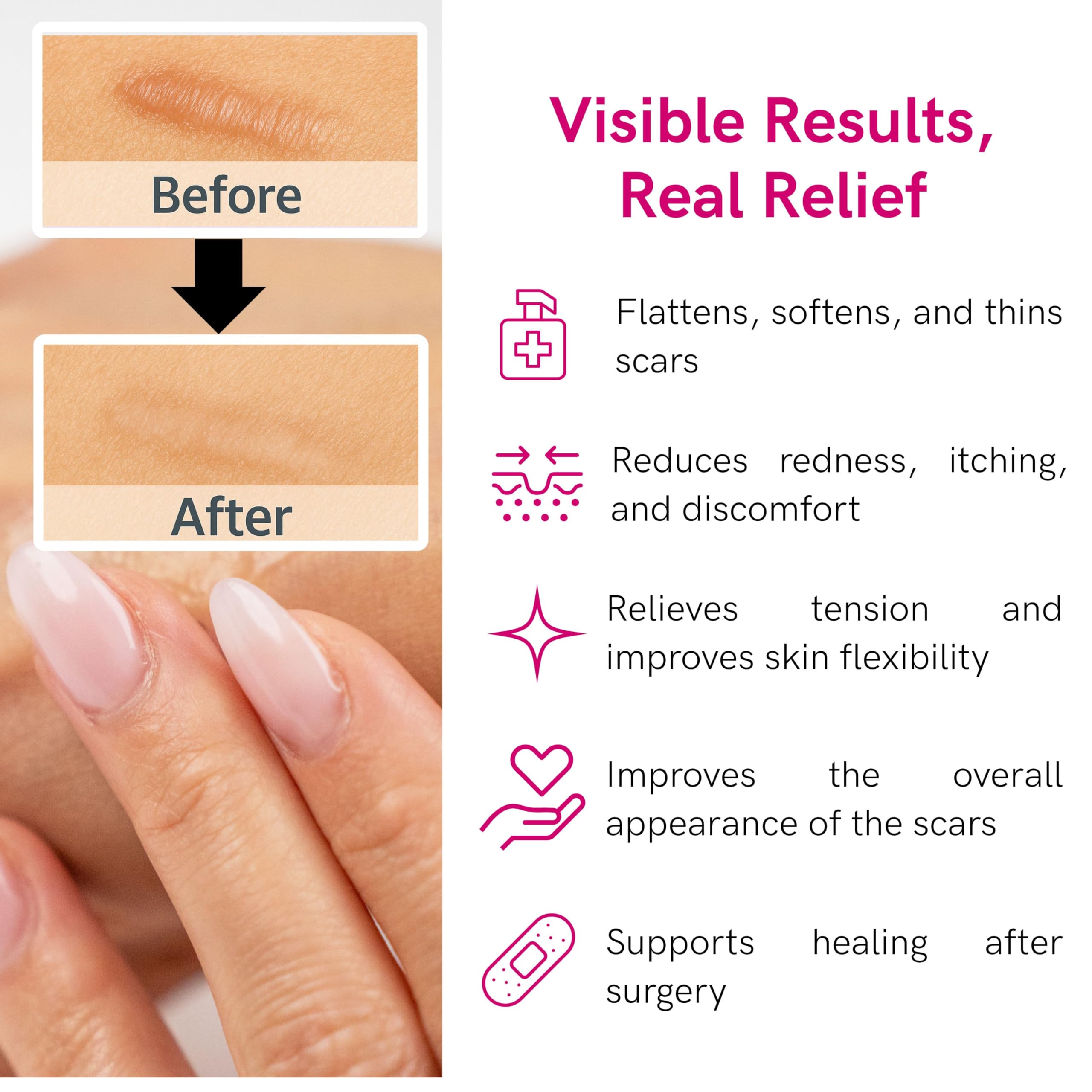 Lipoelastic gel silicone cicatrici vitamina E 10g trasparente